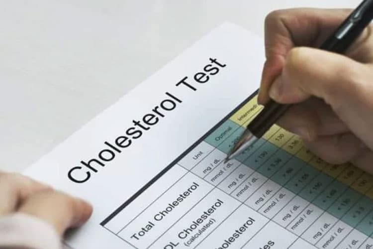 Demi Menurunkan Kadar Kolesterol Usai lebaran, Ini Saran Dokter Gizi