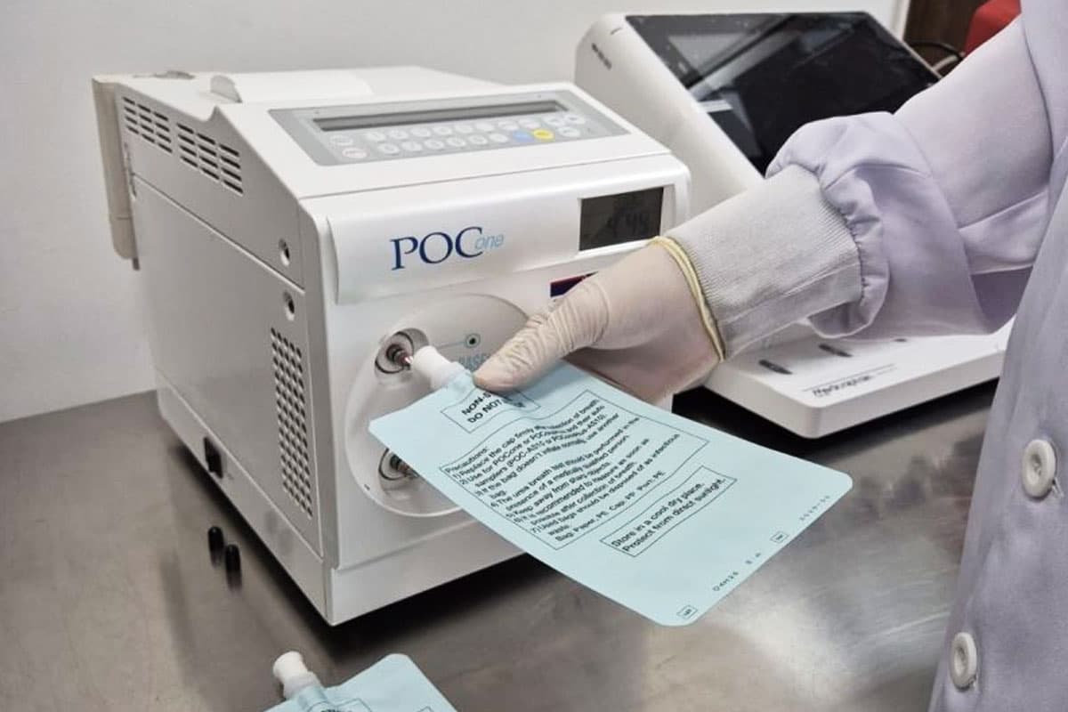 Deteksi Dini H. pylori dengan UBT, Kunci Cegah Kanker Lambung dan Usus